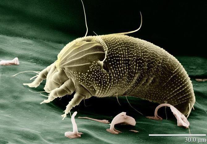 This mite is from a species called Funkotriploynium iagobadius, found in Australia in 1997. This photo of an American species is very similar to that of the funky one. Photo contributed by USDA